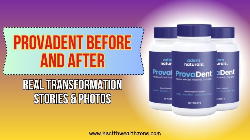 ProvaDent Before and After: Real Transformation Stories & Photos